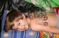 cupping child